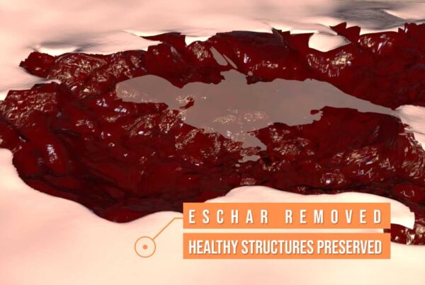 Serda Therapeutics — Wound Treatment Animation